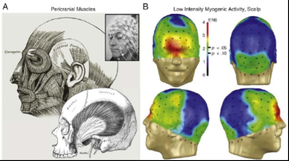 Pericranial Muscles