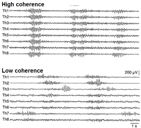 EEG Coherence