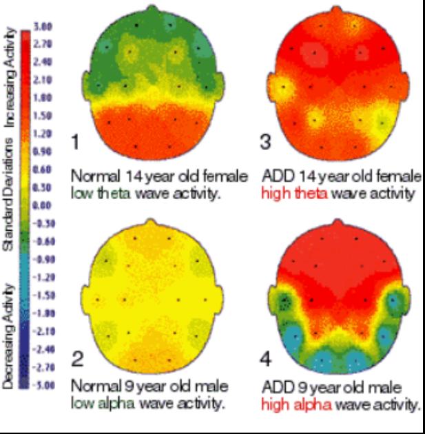 EEG Power Maps